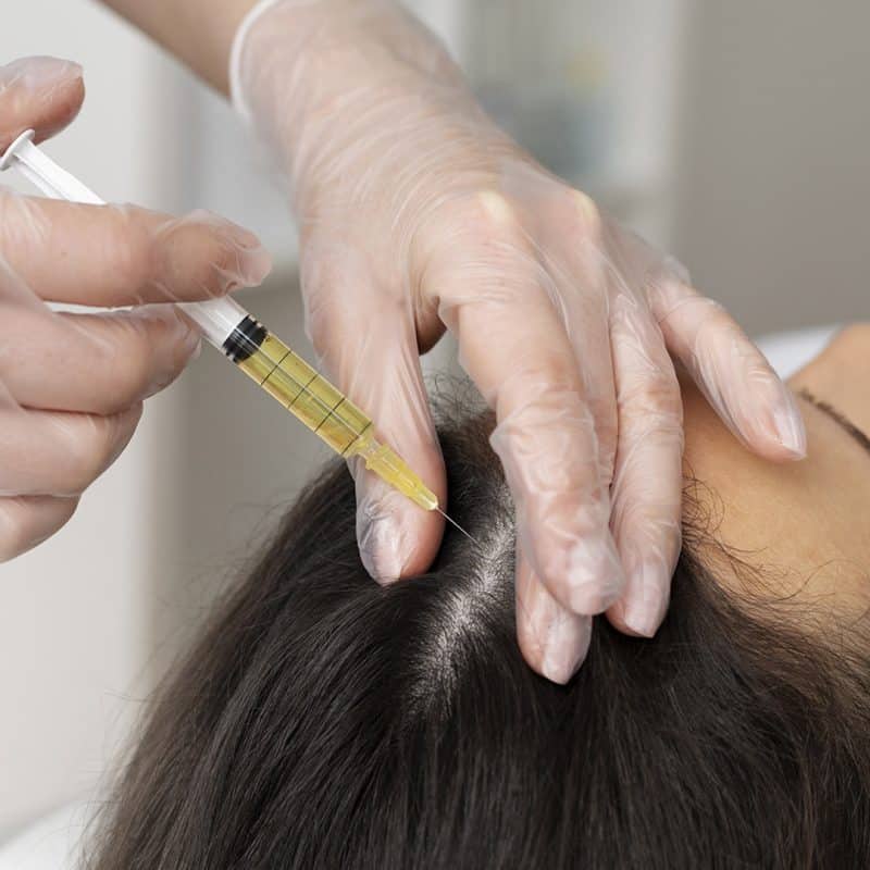 Hair Loss Treatment Singapore