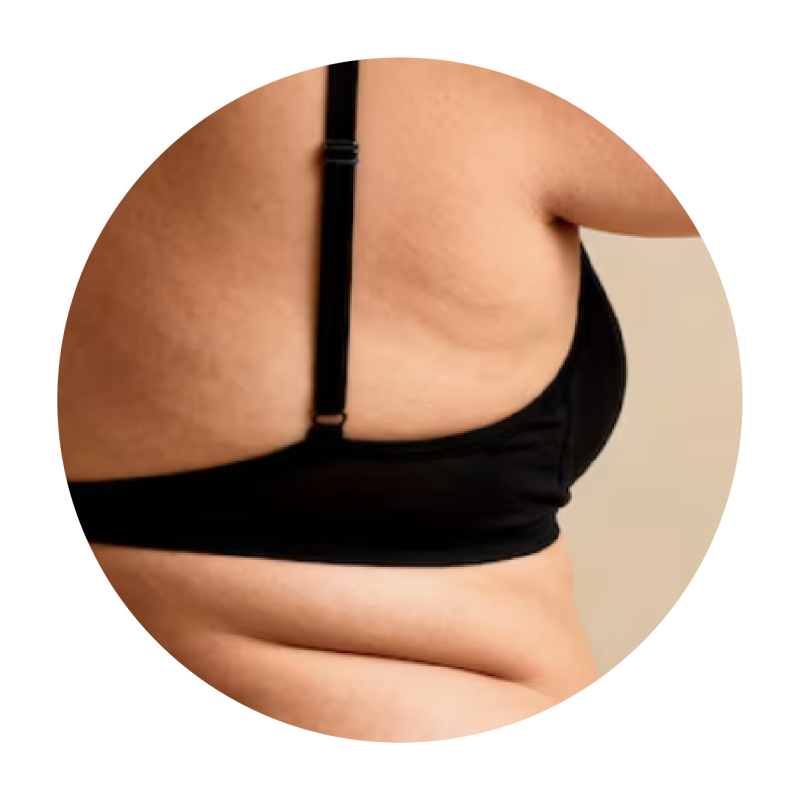 Coolsculpting Elite Singapore