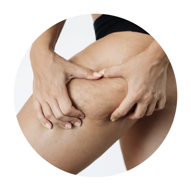 Coolsculpting Elite Singapore