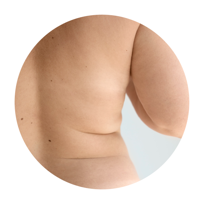 Coolsculpting Elite Singapore