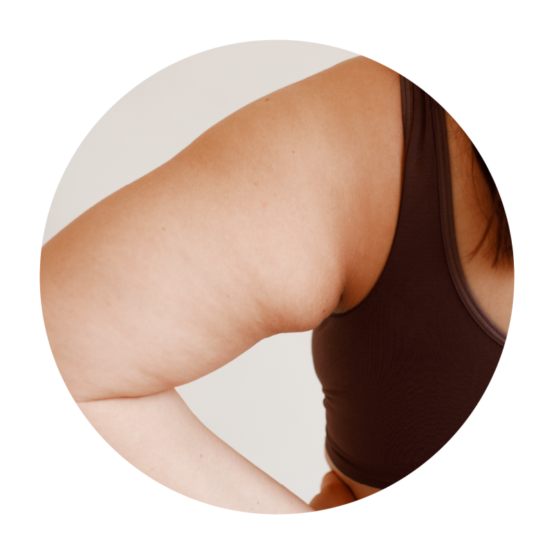 Coolsculpting Elite Singapore
