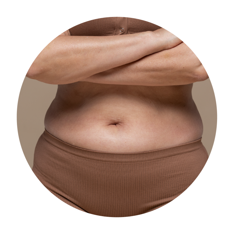 Coolsculpting Elite Singapore