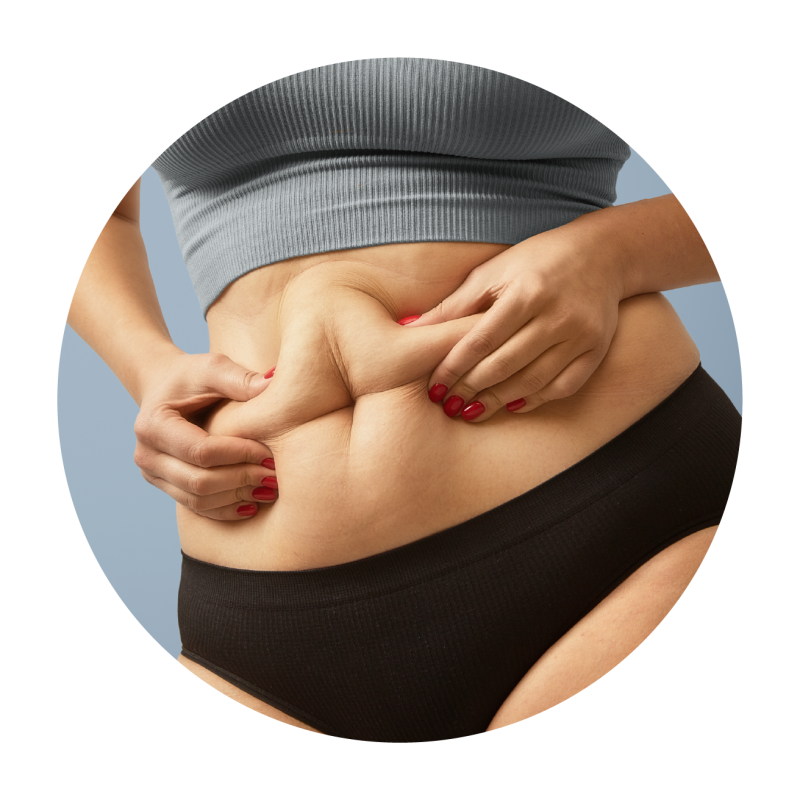 Coolsculpting Elite Singapore