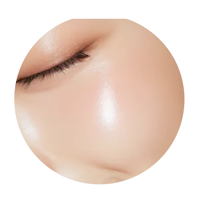 Gold RF Microneedling Singapore