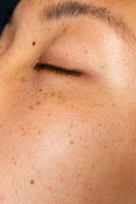 Melanin Reset Program