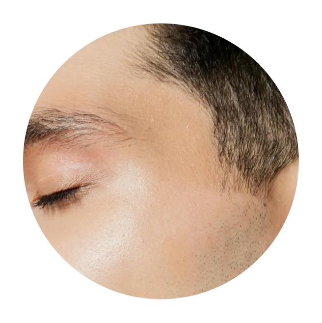 Dermal Fillers for the Nose, Chin and Face