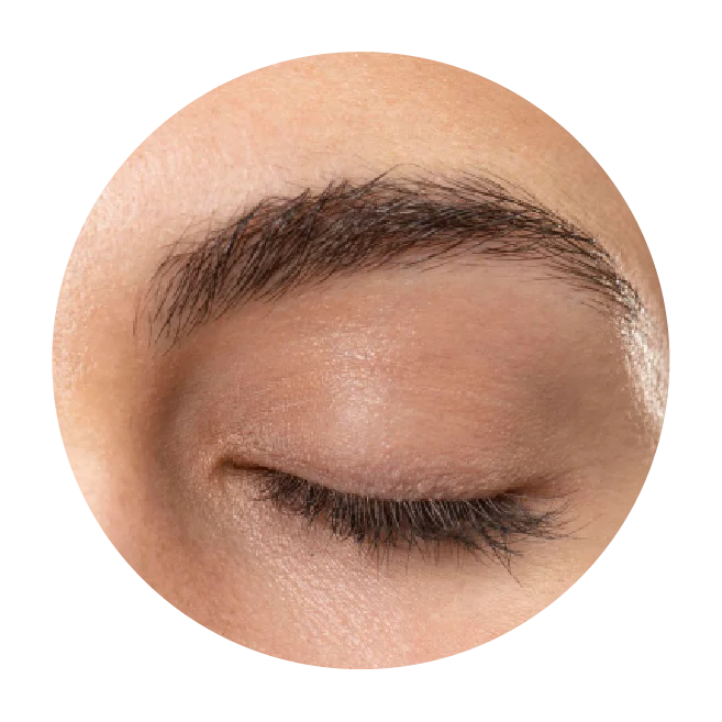 HIFU Plus Non invasive Facelift