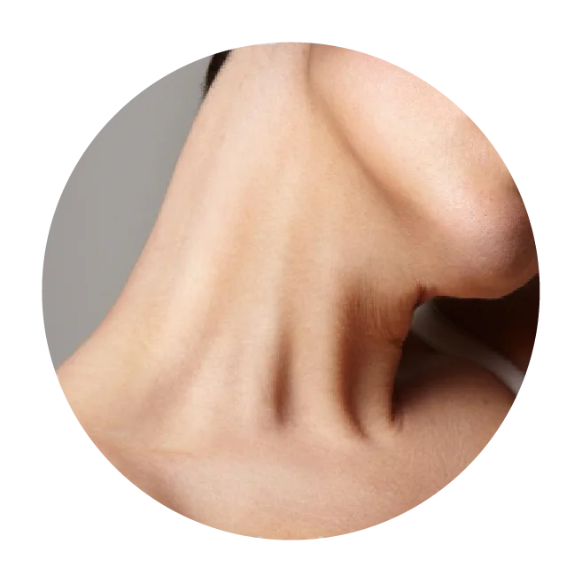 HIFU Plus Non invasive Facelift