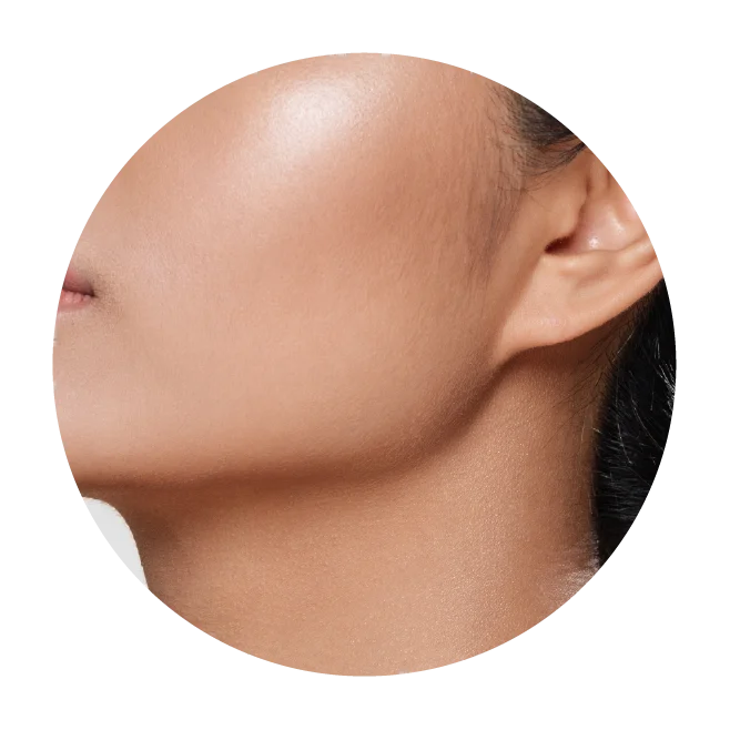 HIFU Plus Non invasive Facelift