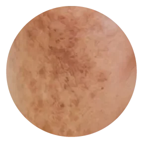 Melanin Reset Program